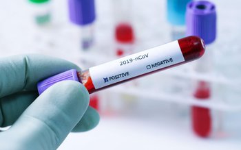 Cazul cinci confirmat cu COVID-19 …