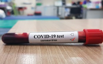 DSP a decis testarea a …