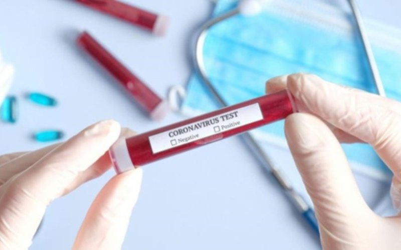 Începând cu 1 iunie se va face testarea imunologică în România