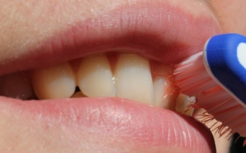 Ingrediente la îndemâna tuturor care reduc tartrul și albesc dinții