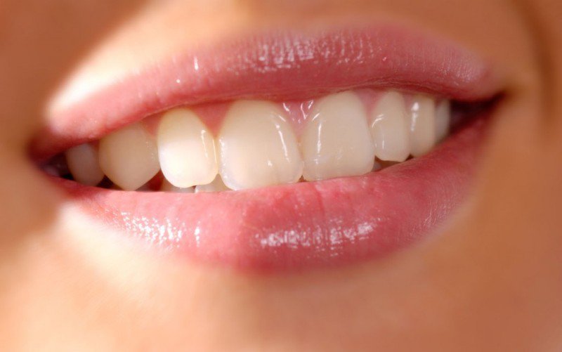 Preparate naturale pentru dinți frumoși