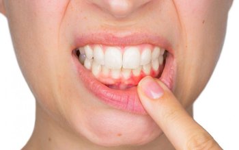 Boala care pare inofensivă, dar …