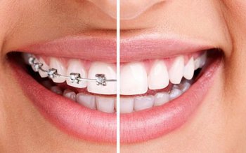 Vârsta maximă până la care …