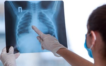 Un medic radiolog atrage atenția! …