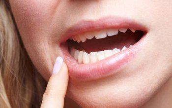 Probleme dentare provocate de stres