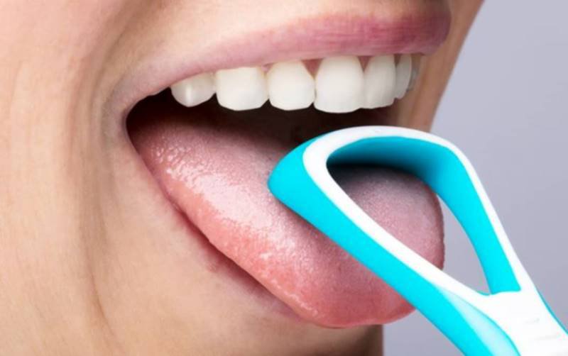 Afecțiuni pe care le poți avea dacă ai limba încărcată de depozite albicioase sau gălbui