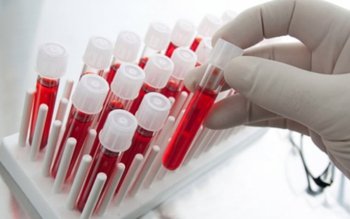 Un test sangvin ar putea …