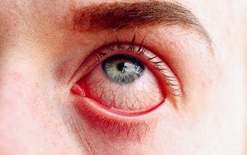 Două noi simptome „ciudate” Omicron …