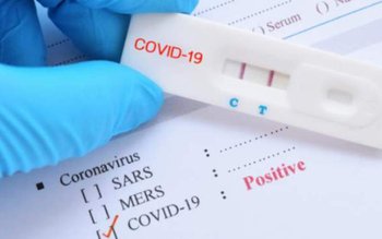 Românii care au avut Covid-19 …