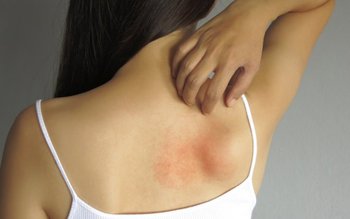 Cum recunoaștem și cum tratăm …