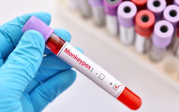 Spania raportează primul deces cauzat …