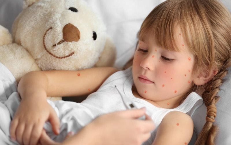 Cinci dintre cele mai frecvente boli ale copilăriei care nu ar trebui să te îngrijoreze