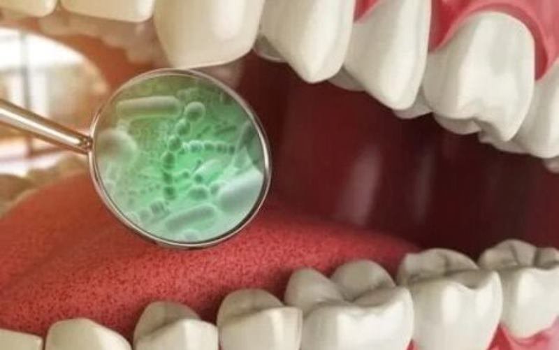 Descoperă ce bacterie din gură îți poate distruge creierul