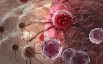 Semne care anunță leucemia: care …