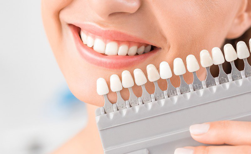 Modalități naturale pentru albirea dinților