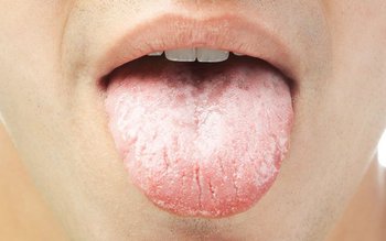 De ce ni se usucă …