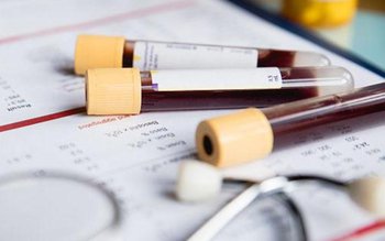 Analize gratuite! Cine va beneficia …