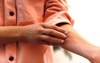 Remediu naturist care tratează iritațiile …