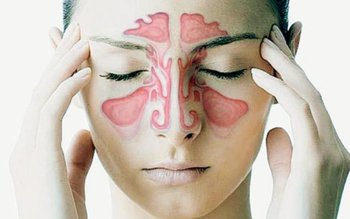 Sinuzita: cum să o recunoașteți …