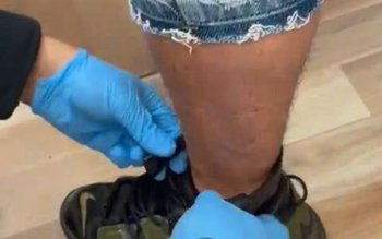 Control judiciar supravegheat cu dispozitiv …