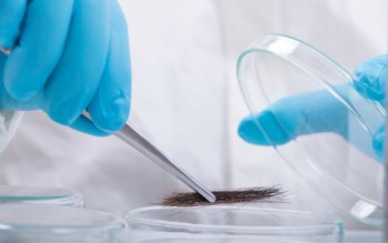 Analiza firului de păr un …