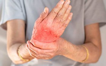 De ce apare artrita cronică