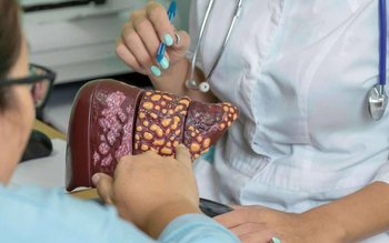 Boala ficatului gras. Cum apare …