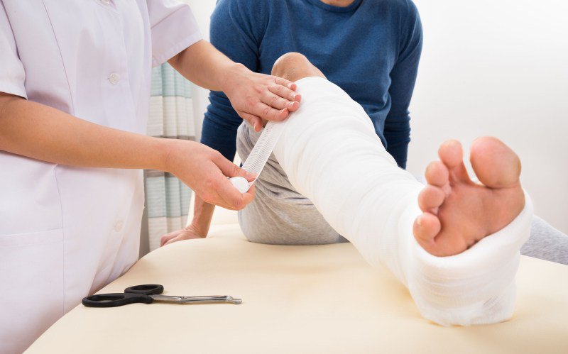 În cât timp se sudează un os fracturat? Ghid complet despre procesul de vindecare