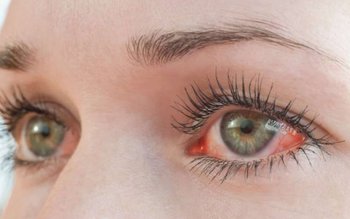 Cauze, simptome și tratament pentru …