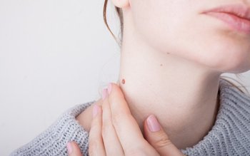 Tratamente naturiste care ne scapă …