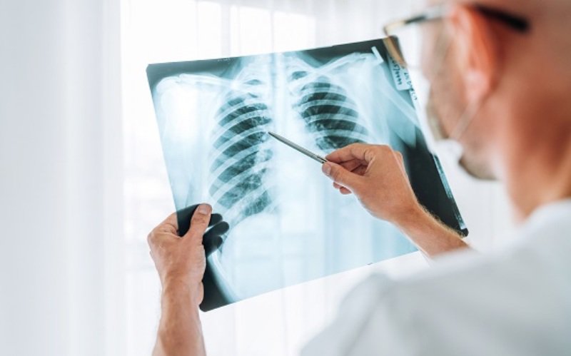 Cum să evaluăm sănătatea plămânilor: Semne de boală pulmonară