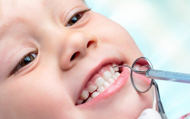 În ce măsură ar trebui să ne îngrijoreze cariile dentare la copii