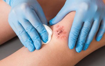 Coagulant natural la îndemâna oricui