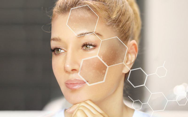 Curăță-ți pielea de pete pigmentare: O abordare umanizată și eficientă