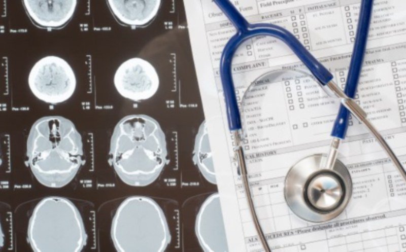 Șase semne care îţi spun că urmează să faci un atac cerebral