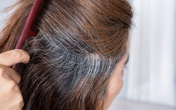 Cauze ale albirii părului de …